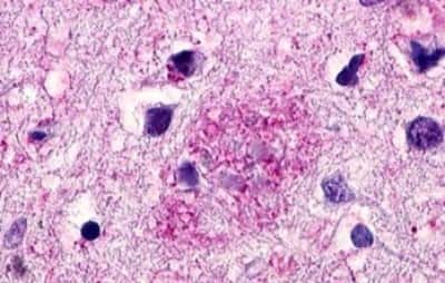 Immunohistochemistry: GPR119 Antibody [NBP3-14345]